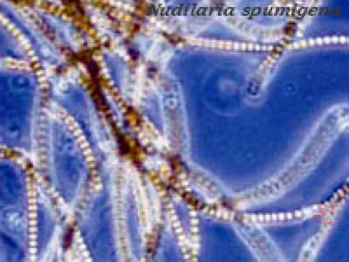 Växtplankton av arten Nodularia Spumigena.